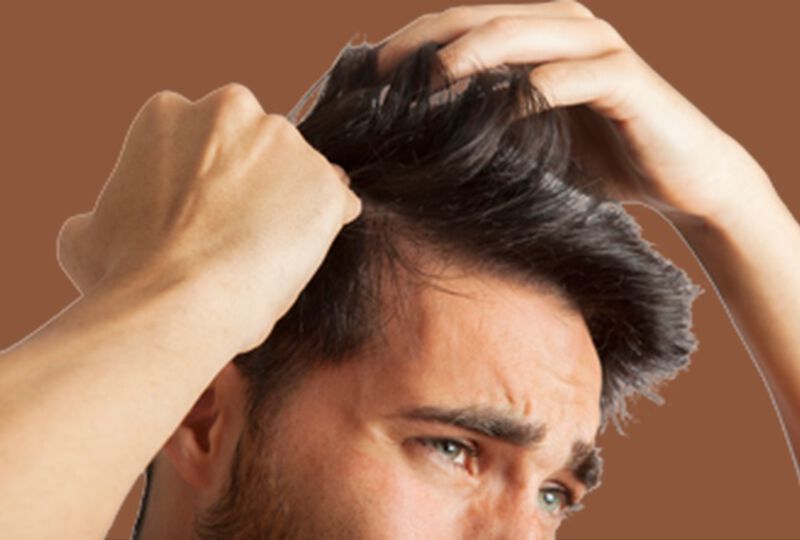 Où acheter du finasteride
