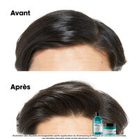 Argile 2-en-1 purifiante anti-gras Scalp Advanced 250ml