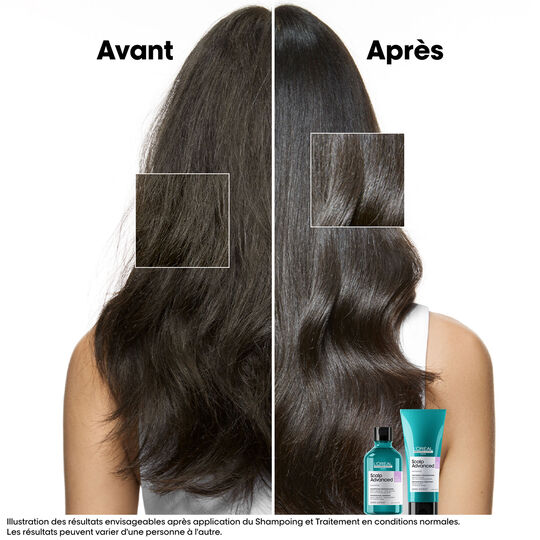 Shampooing dermo-r&eacute;gulateur anti-inconfort Scalp Advanced 1500ml