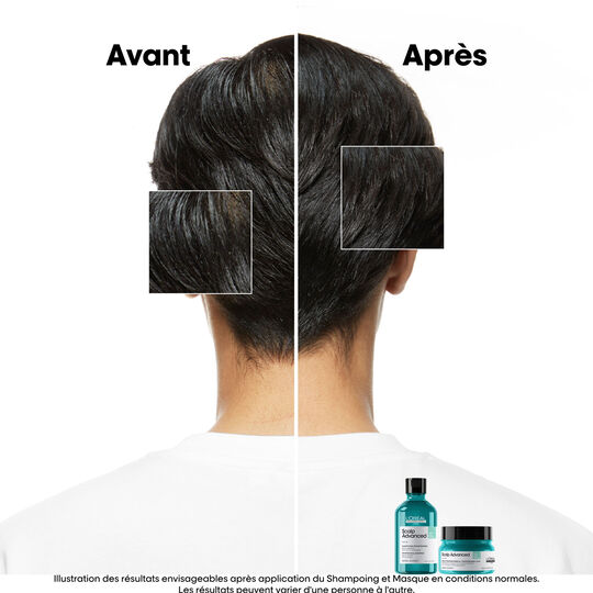 Argile 2-en-1 purifiante anti-gras Scalp Advanced 250ml