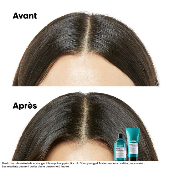 Shampooing dermo-r&eacute;gulateur anti-inconfort Scalp Advanced 1500ml