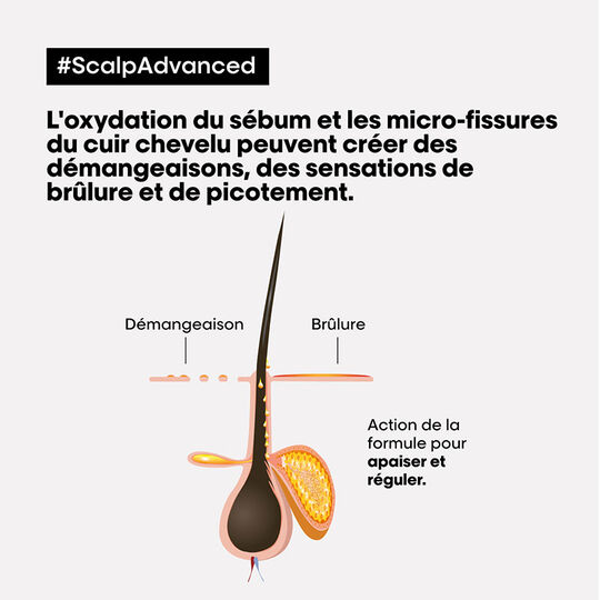 Shampooing dermo-régulateur anti-inconfort Scalp Advanced 300ml