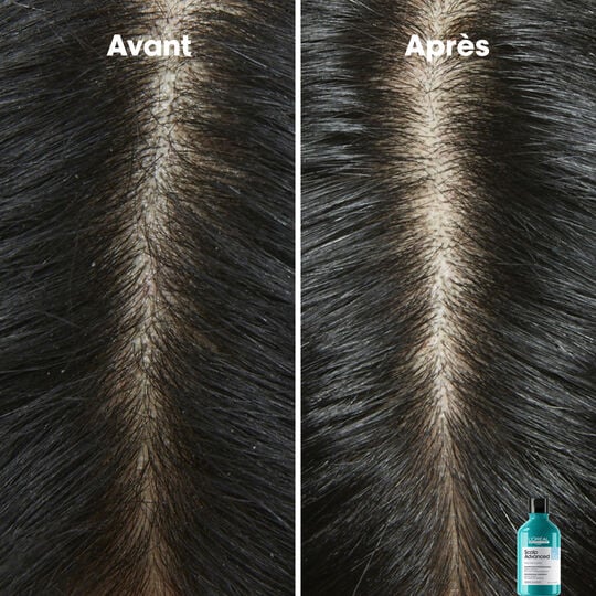 Shampooing dermo-clarifiant anti-pelliculaire Scalp Advanced 500ml