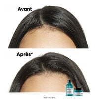 Shampooing dermo-purifiant anti-gras Scalp Advanced 300ml