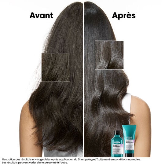 Shampooing dermo-r&eacute;gulateur anti-inconfort Scalp Advanced 500ml