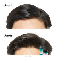 Shampooing dermo-purifiant anti-gras Scalp Advanced 1500ml