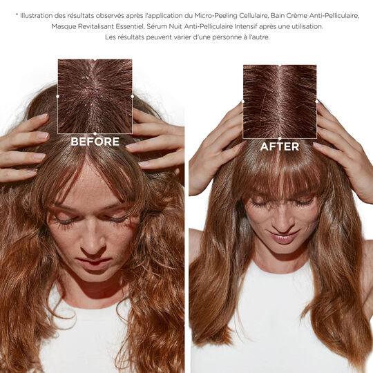 Bain cr&egrave;me anti-pelliculaire Symbiose