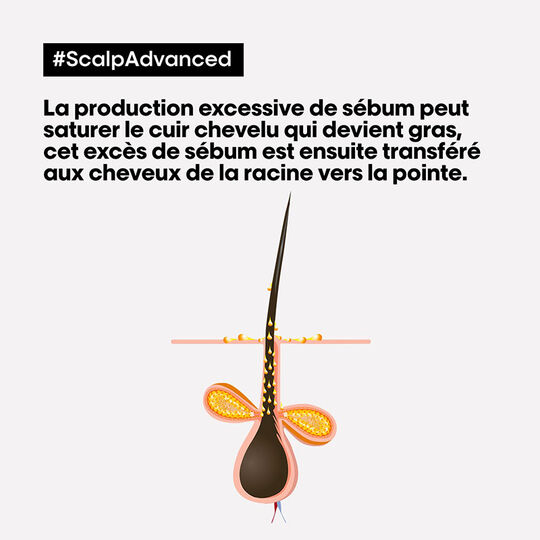 Shampooing dermo-purifiant anti-gras Scalp Advanced 300ml