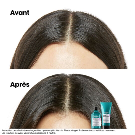 Shampooing dermo-r&eacute;gulateur anti-inconfort Scalp Advanced 500ml