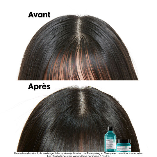 Argile 2-en-1 purifiante anti-gras Scalp Advanced 250ml