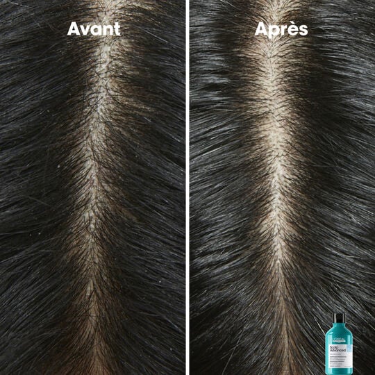 Shampooing dermo-clarifiant anti-pelliculaire Scalp Advanced 300ml