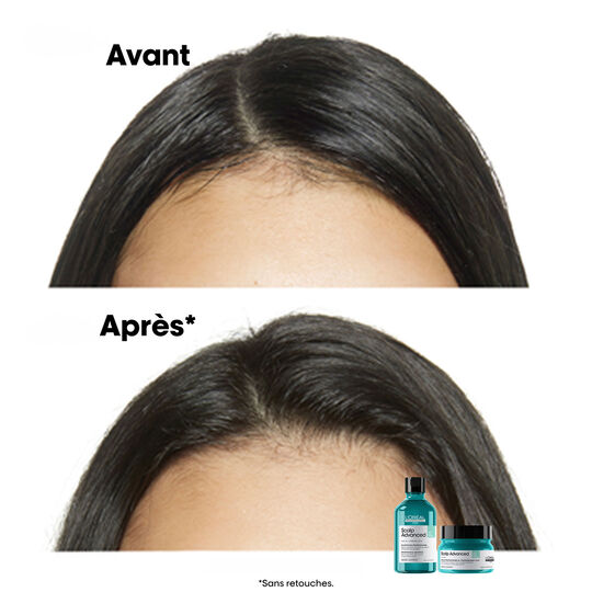 Shampooing dermo-purifiant anti-gras Scalp Advanced 300ml
